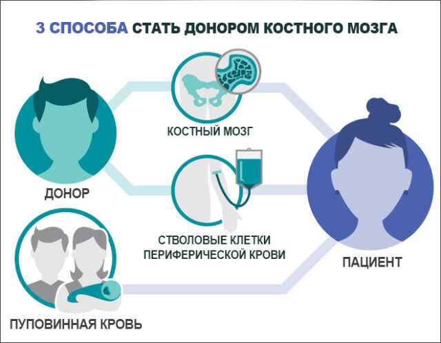 Кто может стать донором костного мозга?